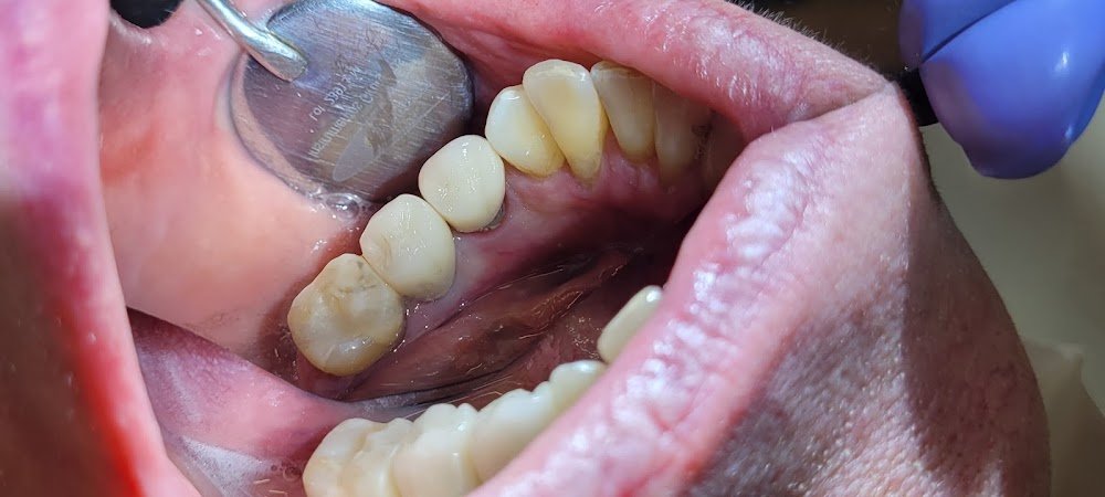Dentista em Piedade SP